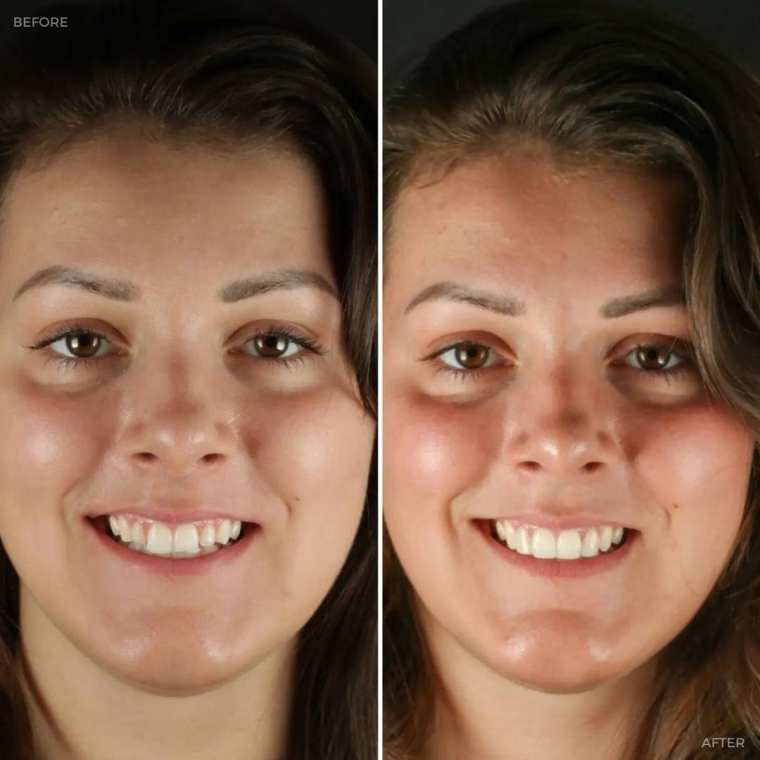 Dentistry @ No.3, 3 Comely Park | Dentistry @ No.3 & Century House Before and after treatment
