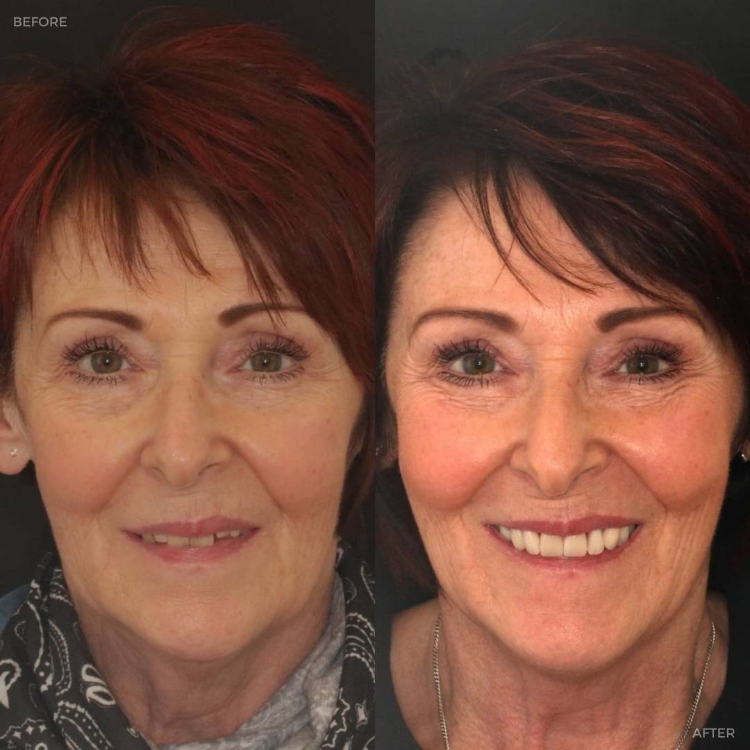Dentistry @ No.3, 3 Comely Park | Dentistry @ No.3 & Century House Before and after treatment