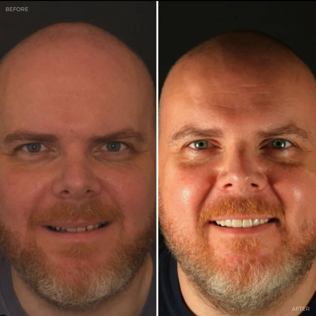 Dentistry @ No.3, 3 Comely Park | Dentistry @ No.3 & Century House Before and after treatment