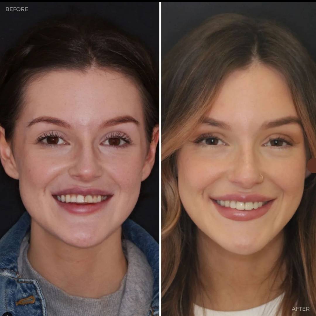 Dentistry @ No.3, 3 Comely Park | Dentistry @ No.3 & Century House Before and after treatment