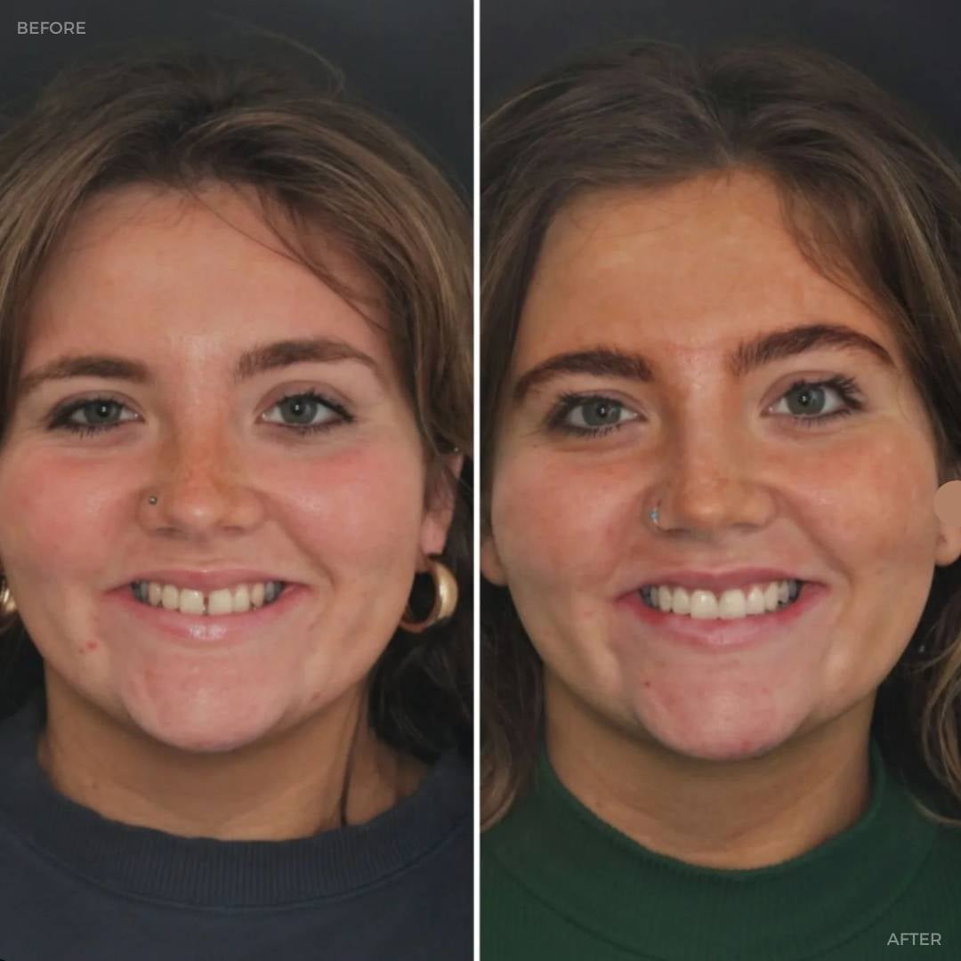 Dentistry @ No.3, 3 Comely Park | Dentistry @ No.3 & Century House Before and after treatment