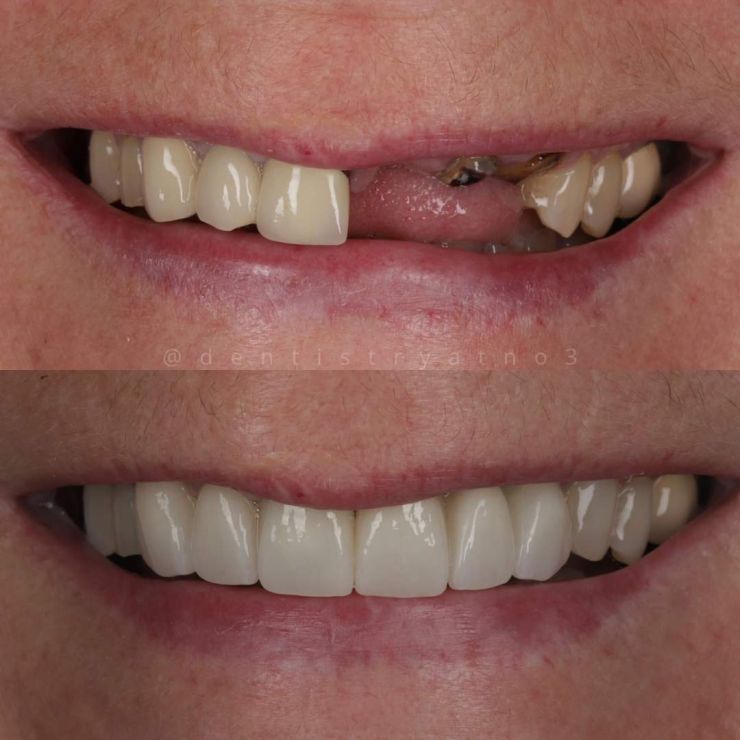 Smile Gallery | Dentistry @ No.3 & Century House Transforming Smiles