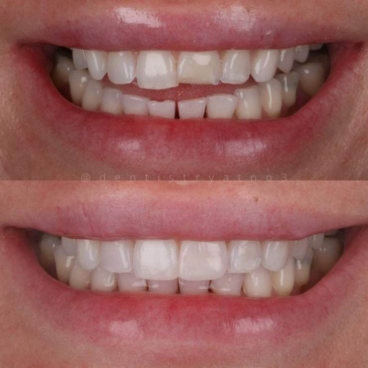 Smile Gallery | Dentistry @ No.3 & Century House Transforming Smiles