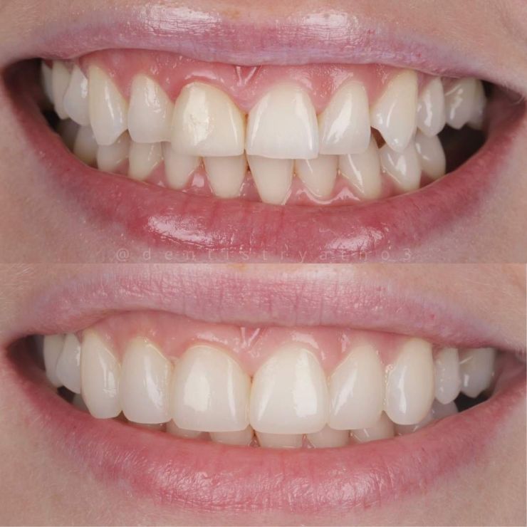 Smile Gallery | Dentistry @ No.3 & Century House Transforming Smiles