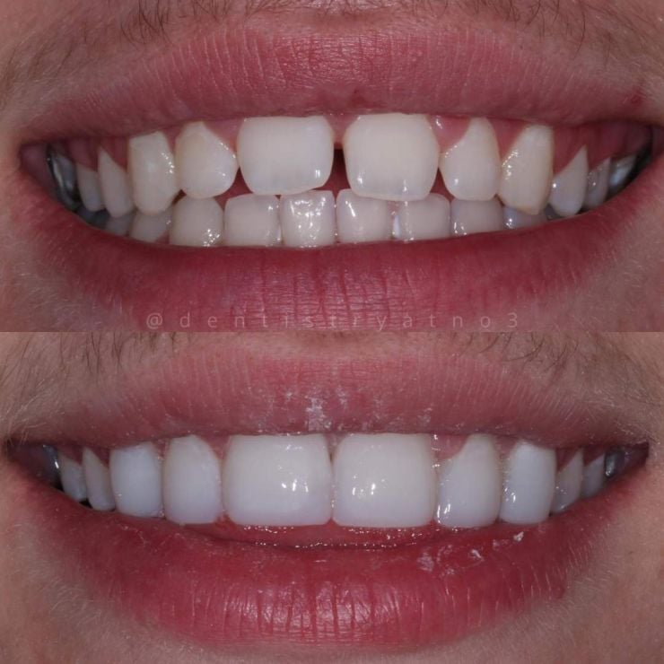 Smile Gallery | Dentistry @ No.3 & Century House Transforming Smiles
