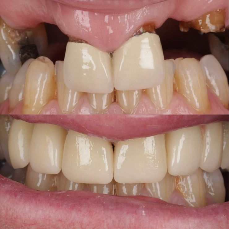 Smile Gallery | Dentistry @ No.3 & Century House Transforming Smiles