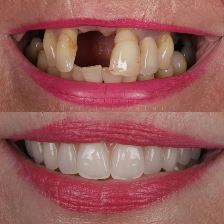 Smile Gallery | Dentistry @ No.3 & Century House Transforming Smiles
