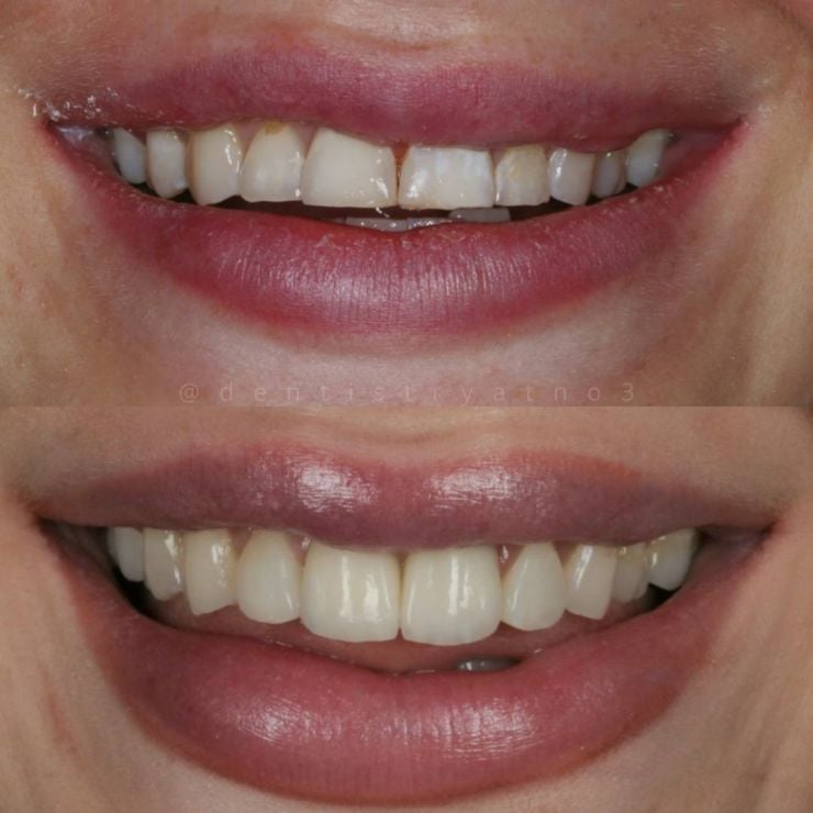 Smile Gallery | Dentistry @ No.3 & Century House Transforming Smiles