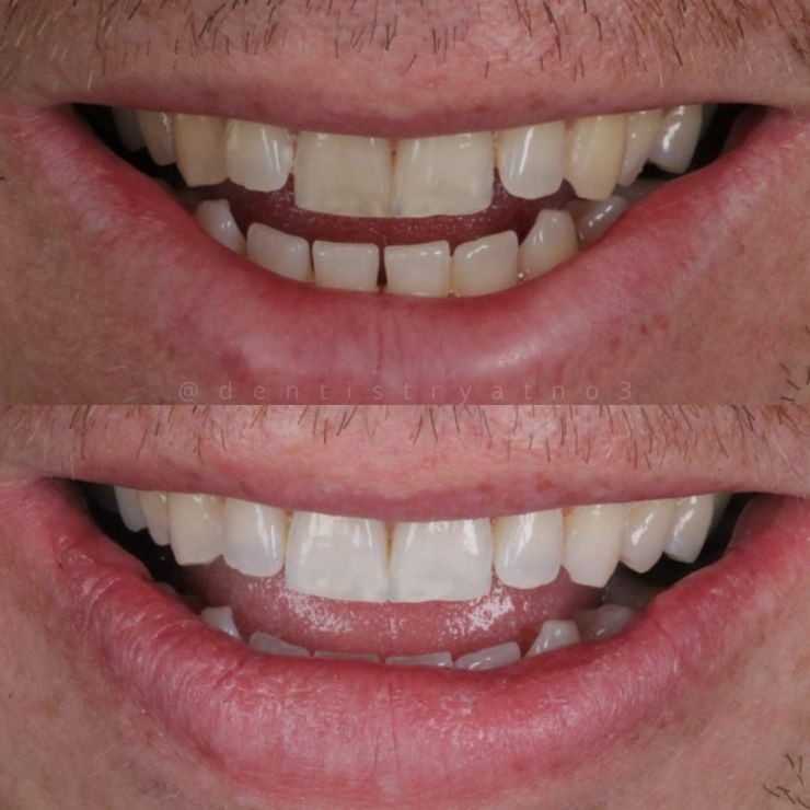 Smile Gallery | Dentistry @ No.3 & Century House Transforming Smiles