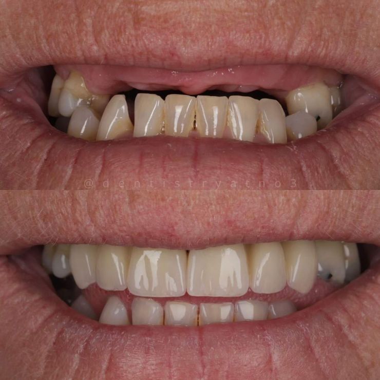 Smile Gallery | Dentistry @ No.3 & Century House Transforming Smiles
