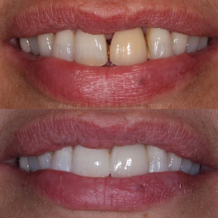 Smile Gallery | Dentistry @ No.3 & Century House Transforming Smiles