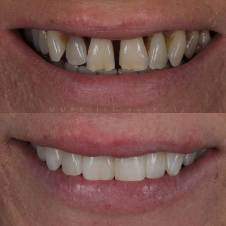 Smile Gallery | Dentistry @ No.3 & Century House Transforming Smiles