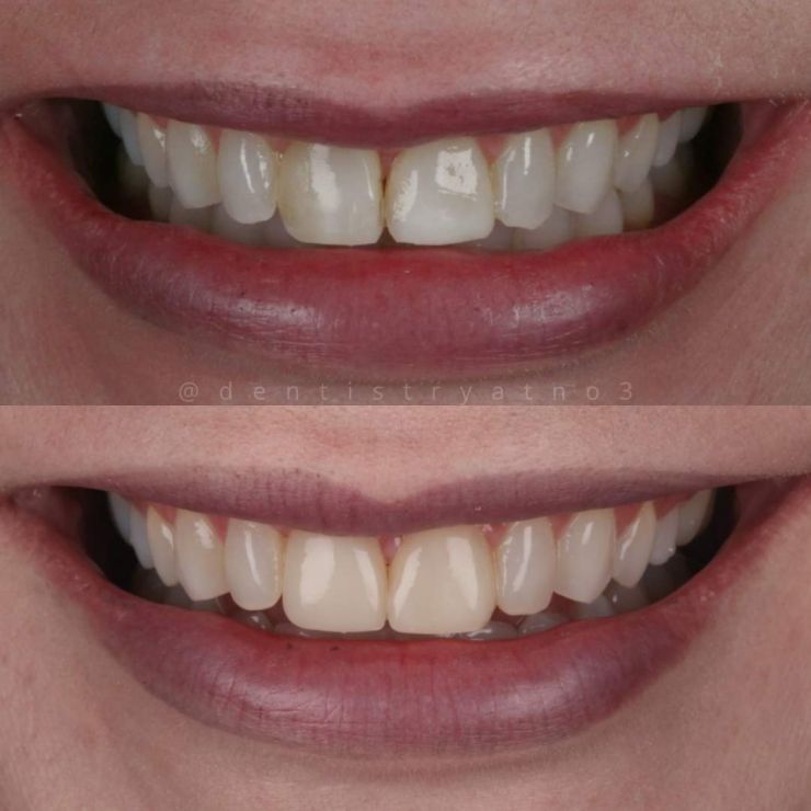 Smile Gallery | Dentistry @ No.3 & Century House Transforming Smiles