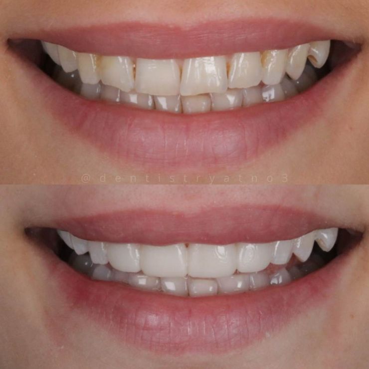 Smile Gallery | Dentistry @ No.3 & Century House Transforming Smiles
