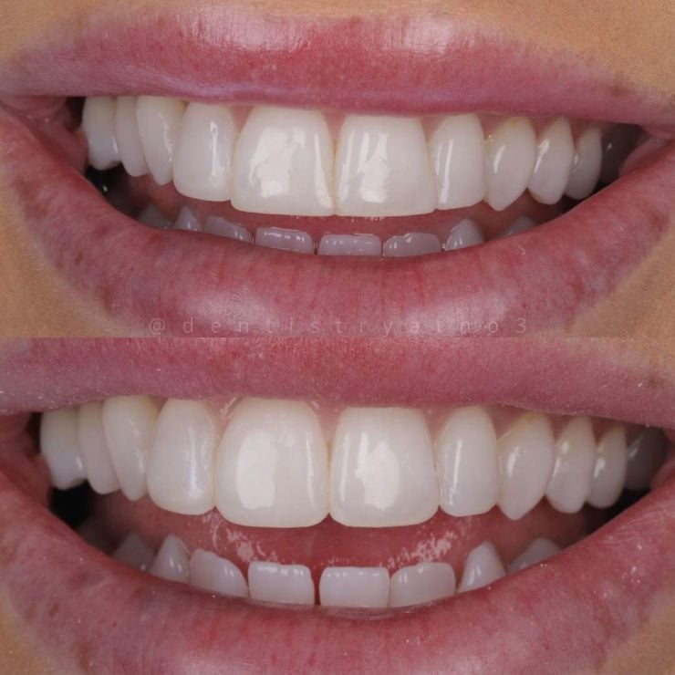 Smile Gallery | Dentistry @ No.3 & Century House Transforming Smiles