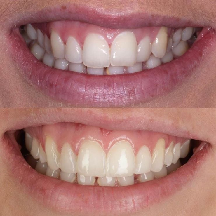 Smile Gallery | Dentistry @ No.3 & Century House Transforming Smiles