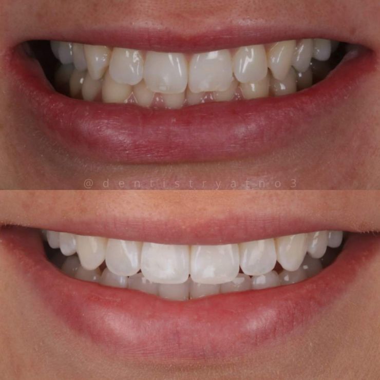 Smile Gallery | Dentistry @ No.3 & Century House Transforming Smiles