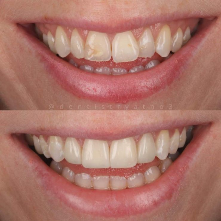 Smile Gallery | Dentistry @ No.3 & Century House Transforming Smiles