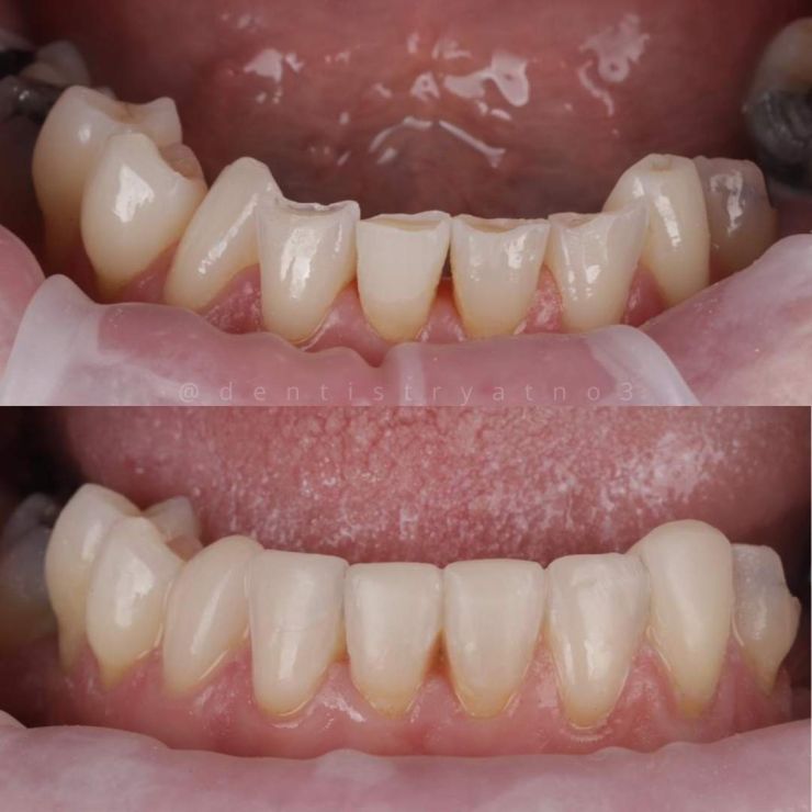 Smile Gallery | Dentistry @ No.3 & Century House Transforming Smiles