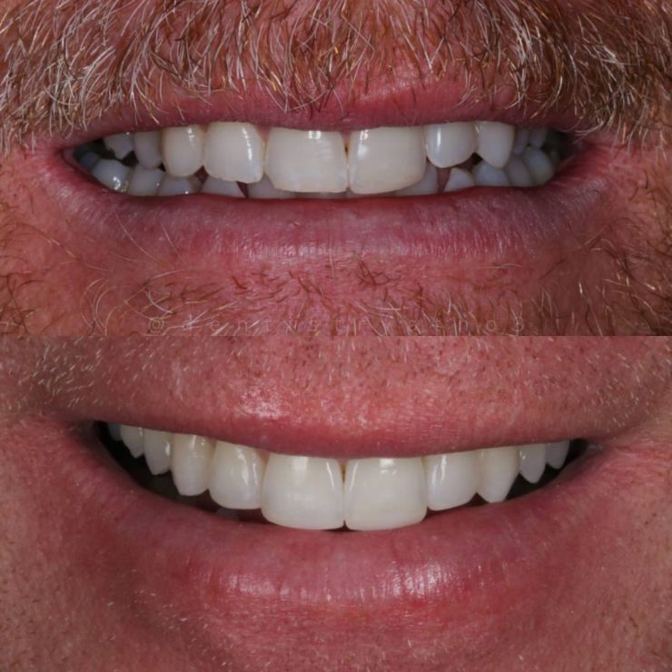 Smile Gallery | Dentistry @ No.3 & Century House Transforming Smiles