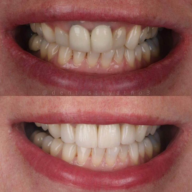 Smile Gallery | Dentistry @ No.3 & Century House Transforming Smiles