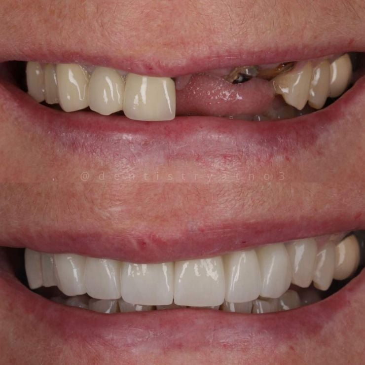 Smile Gallery | Dentistry @ No.3 & Century House Transforming Smiles