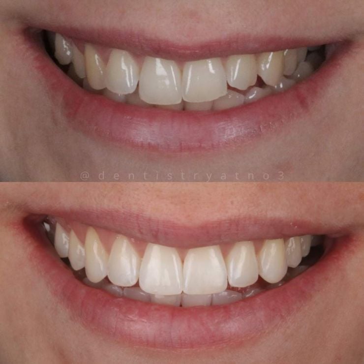 Smile Gallery | Dentistry @ No.3 & Century House Transforming Smiles