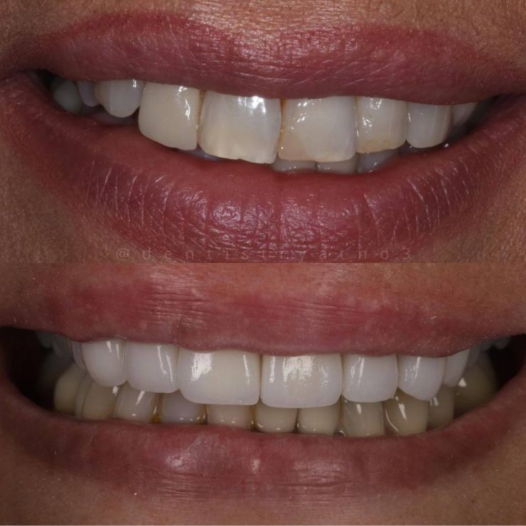 Smile Gallery | Dentistry @ No.3 & Century House Transforming Smiles