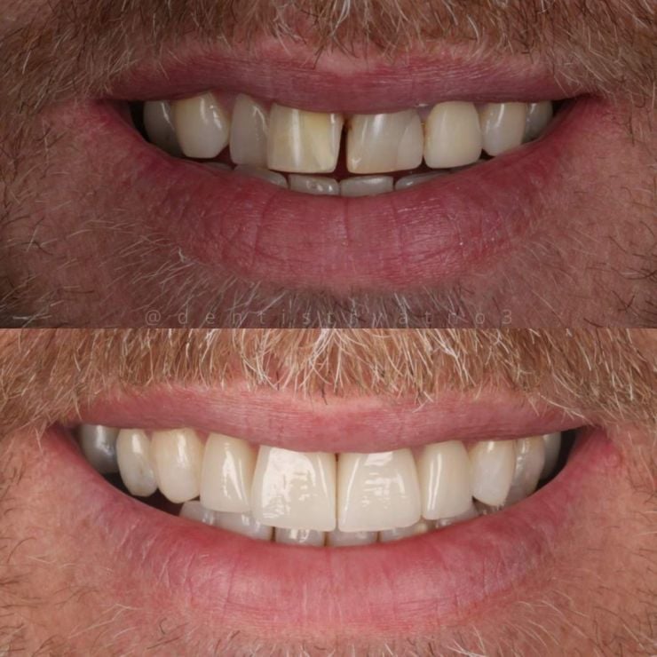 Smile Gallery | Dentistry @ No.3 & Century House Transforming Smiles