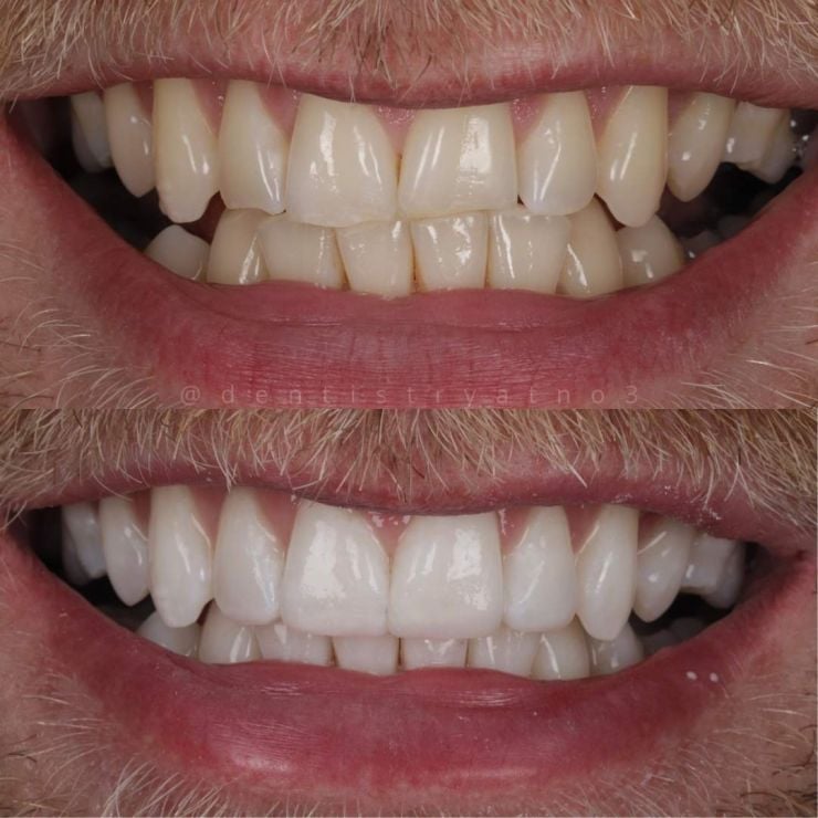 Smile Gallery | Dentistry @ No.3 & Century House Transforming Smiles